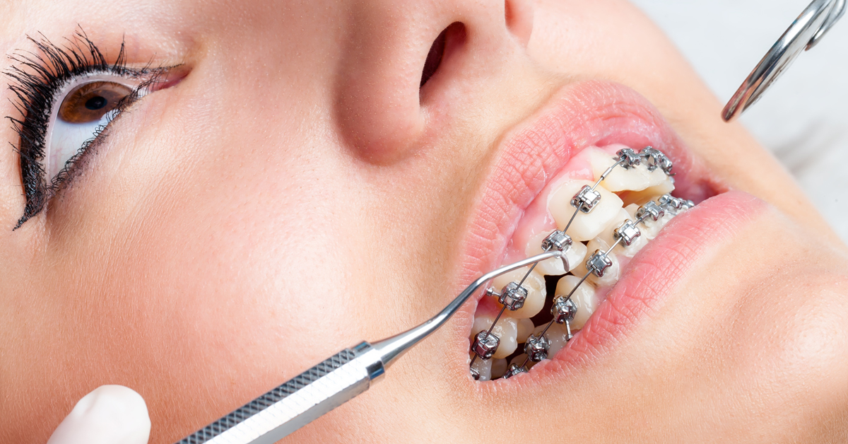 Soluciones para las enfermedades dentales