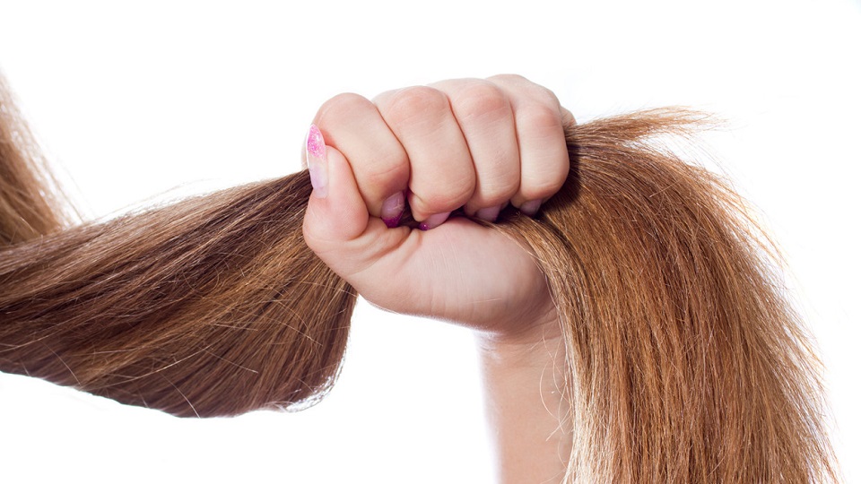 Mãe desesperada raspa o cabelo da filha de dois anos que sofre de tricotilomania