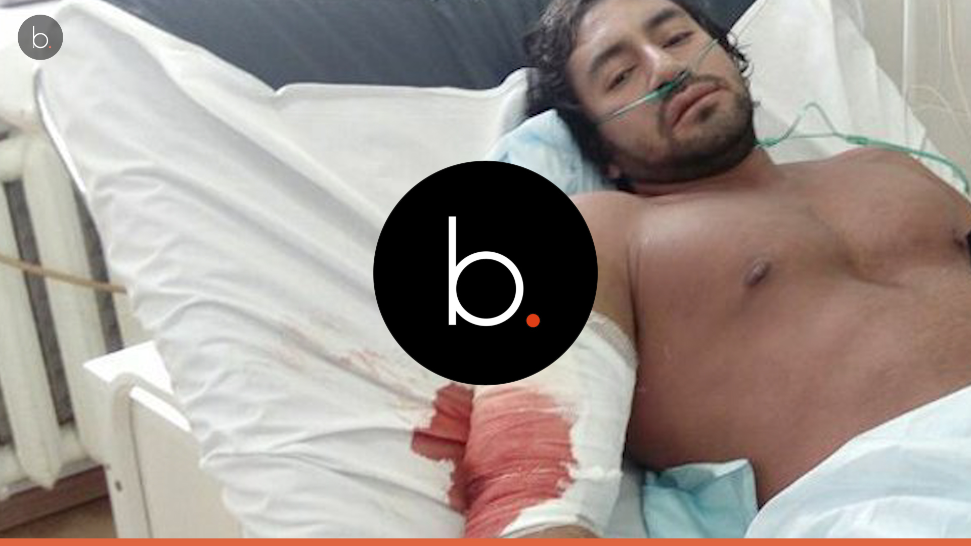 Após lesionar o tríceps durante o treino fisiculturista morre de infecção