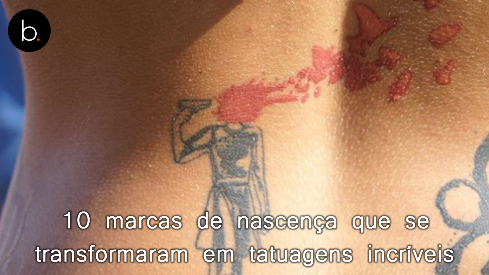10 marcas de nascença que se transformaram em tatuagens incríveis