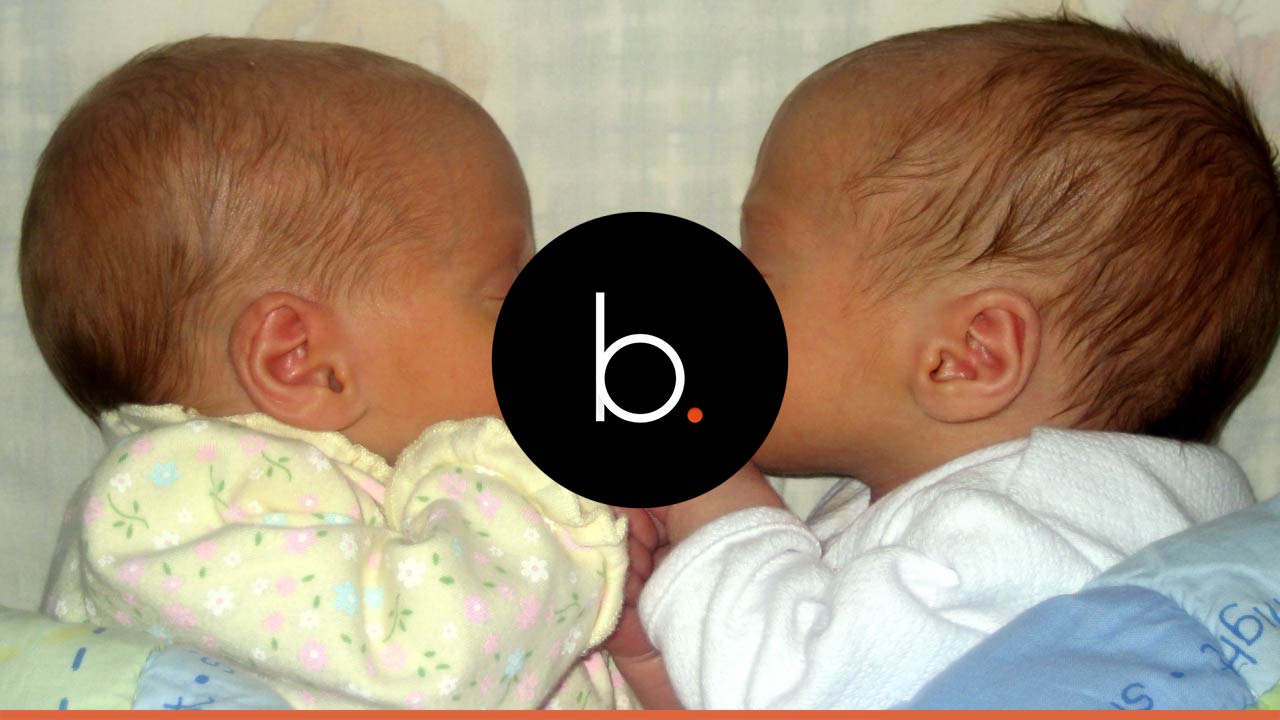 Conjoined twins born in North Carolina are finally separated