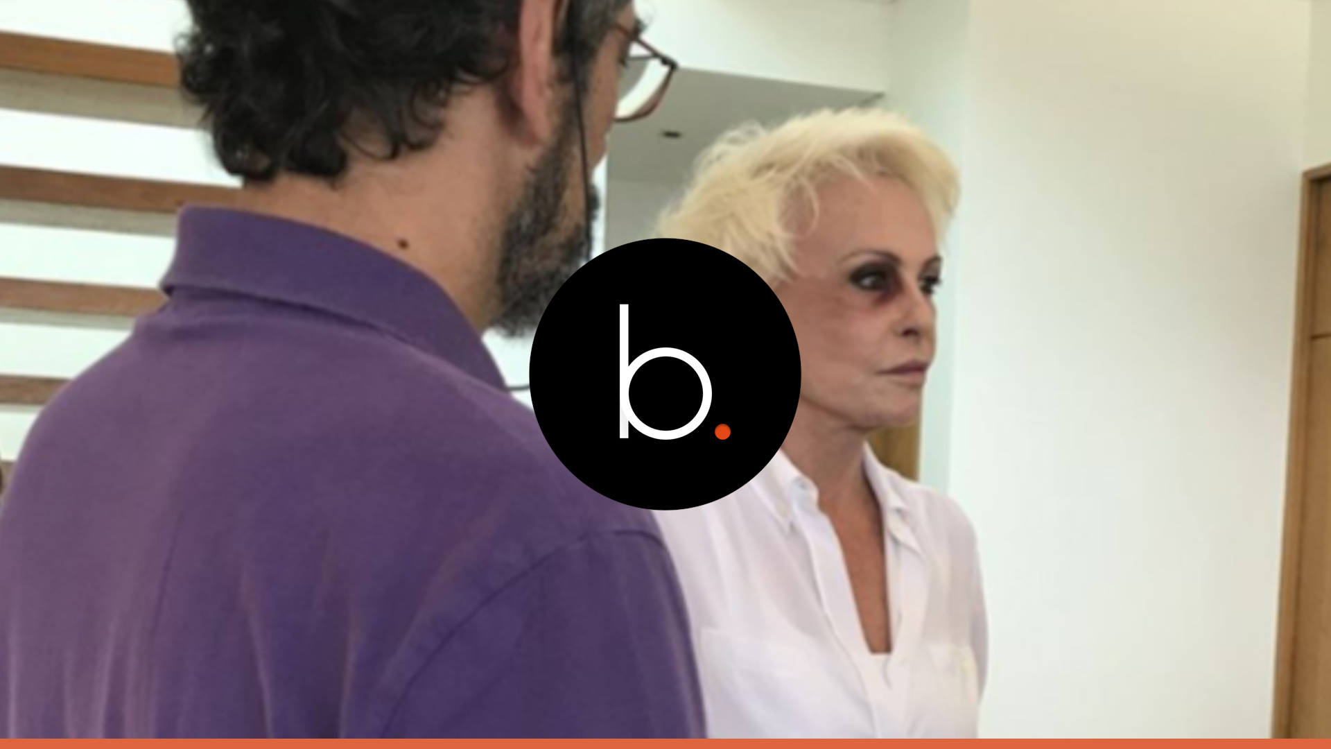 Vídeo emociona: com olho roxo, Ana Braga confessa realidade aterradora: 'Basta'
