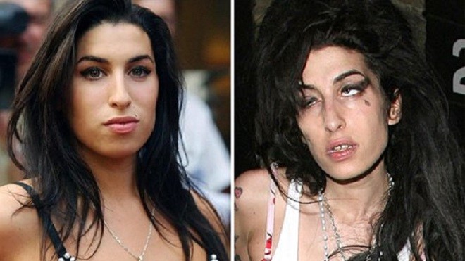 Vídeo: O antes e depois de famosos que se envolveram com as drogas