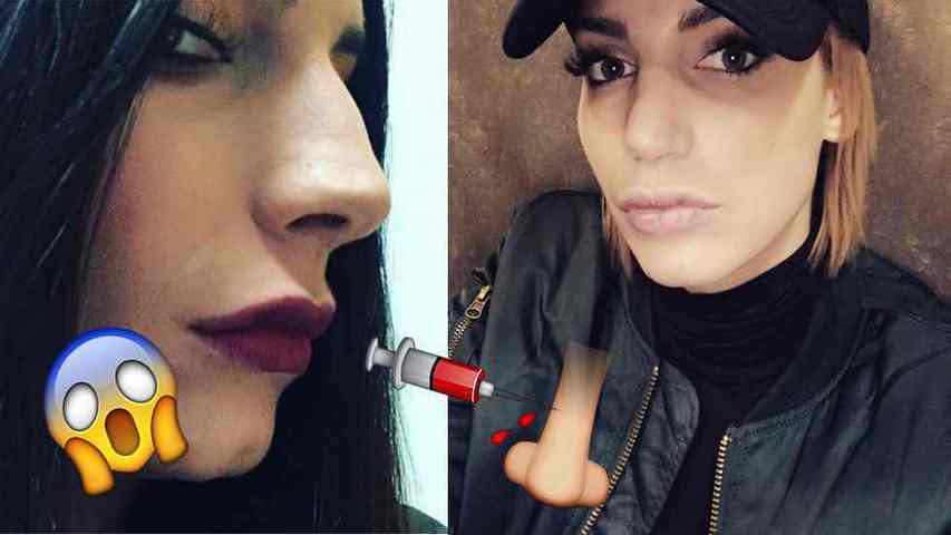 Nadège Lacroix (LVDCB3) regrette son nouveau nez !