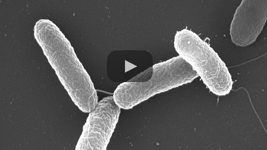 El miedo a la leche para bebés en Francia por contaminación por Salmonella