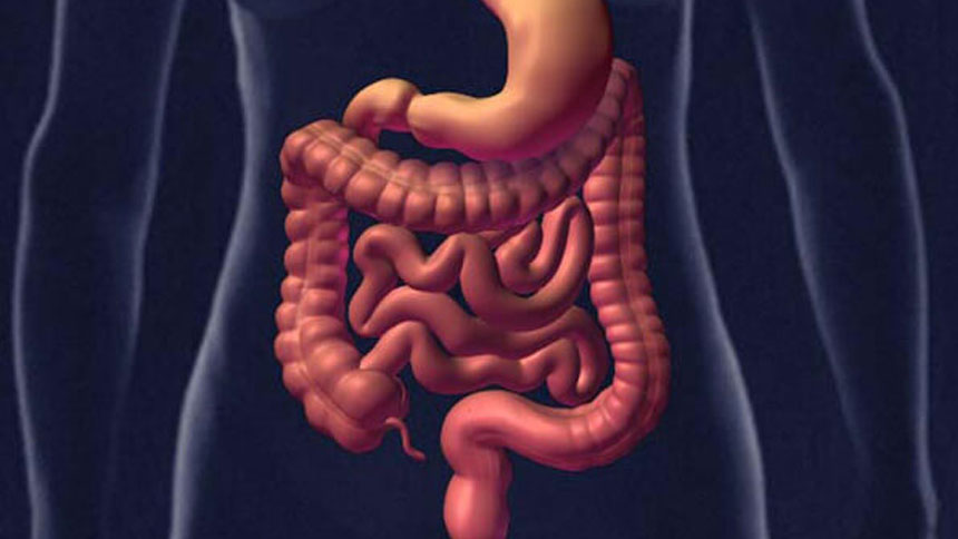 Alimentos que causan inflamación intestinal