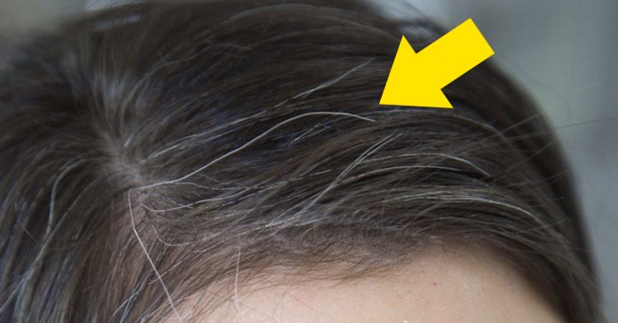 Como y porque se forman las canas