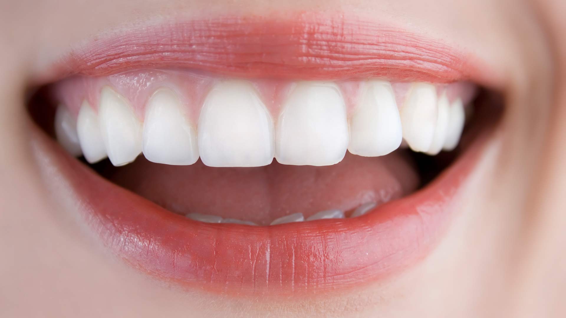La pérdida de dientes reduce la longevidad: esta es la alarma de los expertos