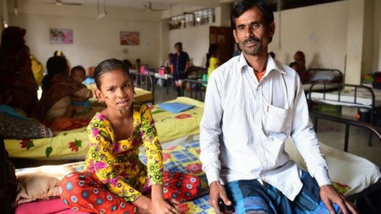 Sahana Khatun, el caso de la niña afectada por el síndrome del hombre árbol