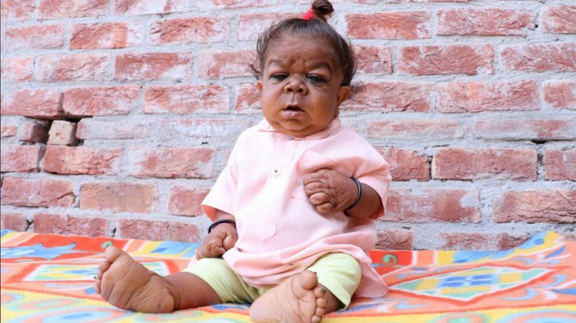 Conheça o "bebê" de 23 anos de idade