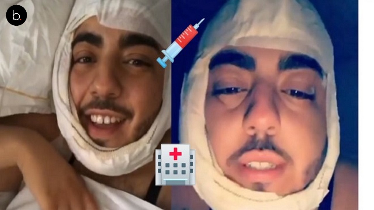 Jaja dévoile les premiers résultats de sa chirurgie esthétique