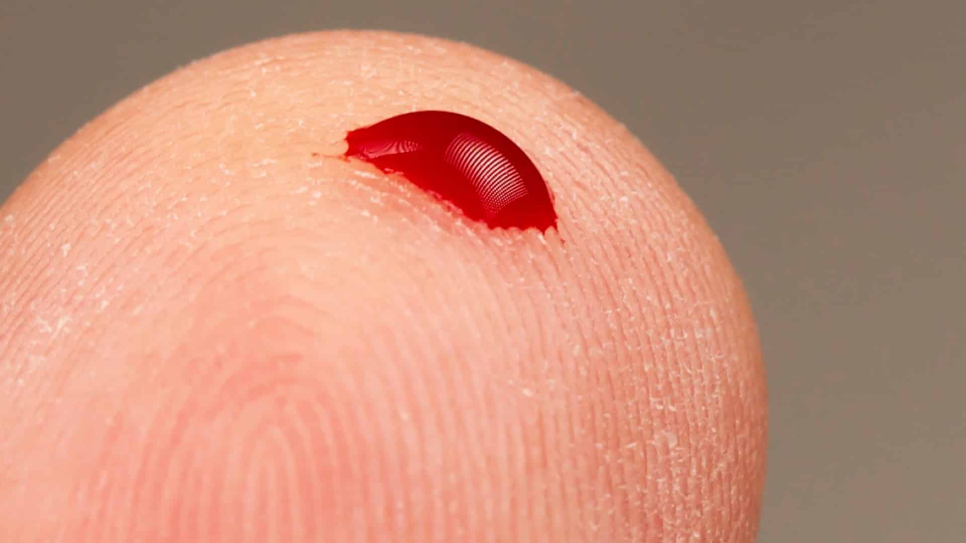 Diabetes en constante crecimiento: los graduados corren menos riesgo
