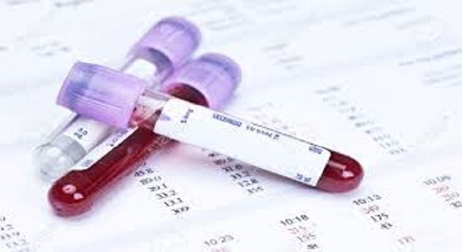 VÍDEO: Entendiendo la importancia de la hematología!