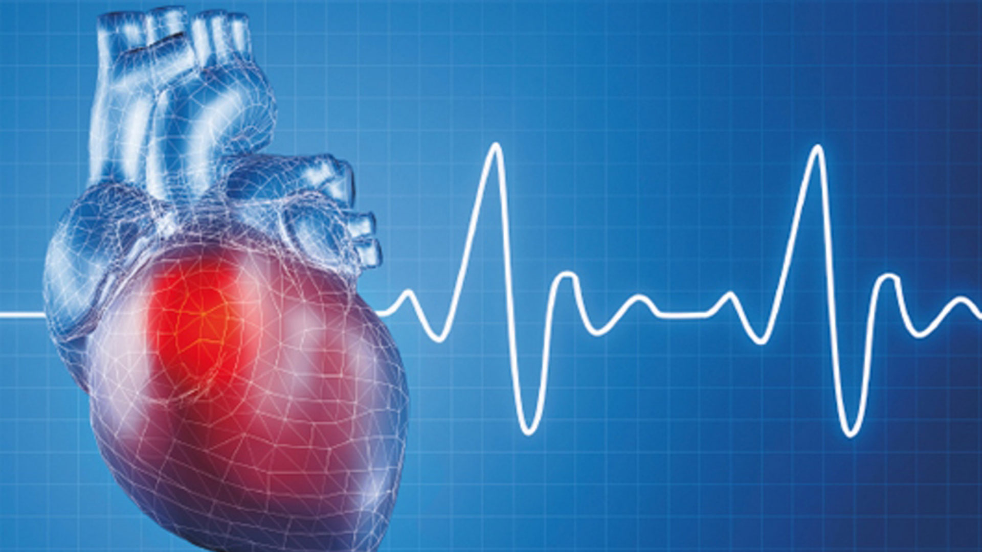Corazón artificial en ritmos de silicona durante 45 minutos