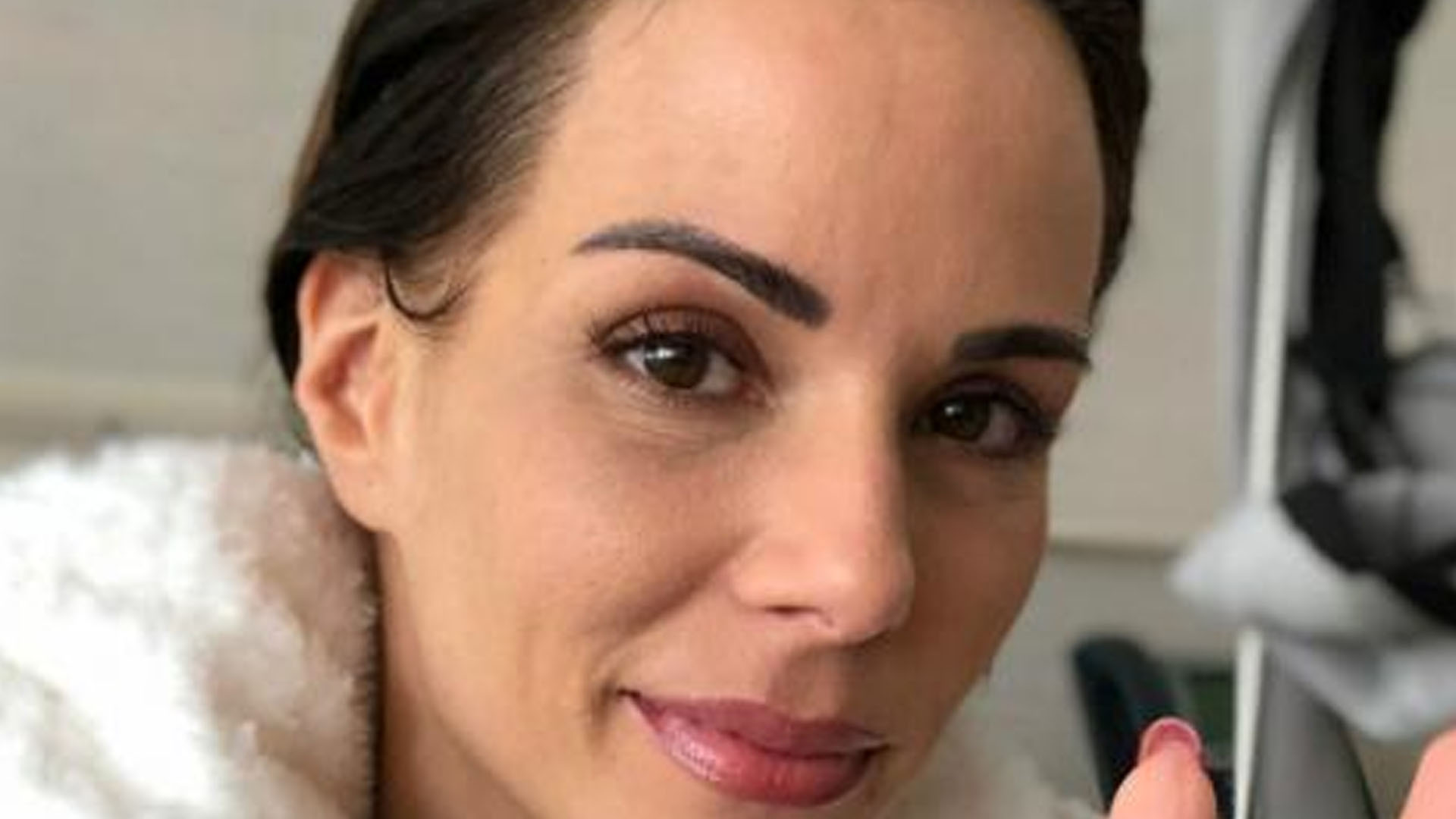 Ana Furtado revela que já notou queda de cabelo