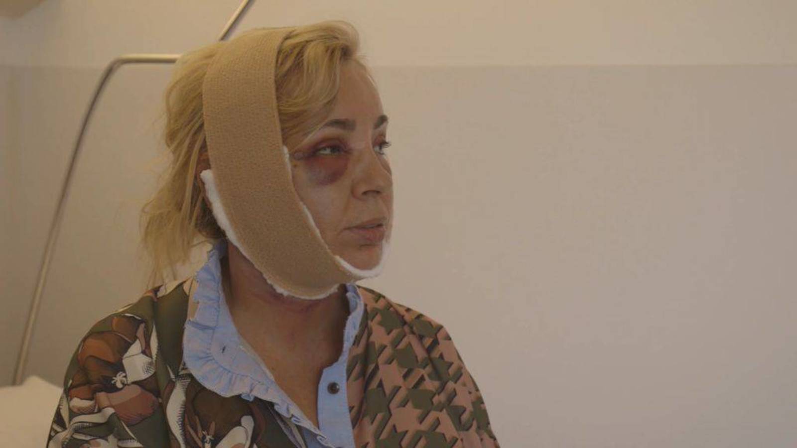 VÍDEO: Carmen Borrego tiene pesadillas a raíz de su operación estética
