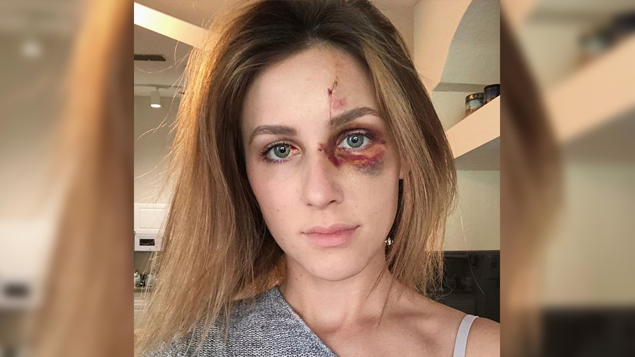 Universitária brasileira é agredida pelo namorado e grava uma parte da discussão