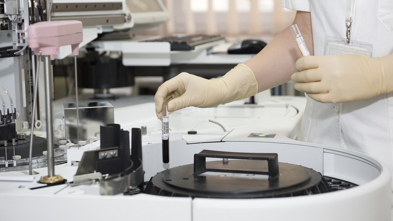 Concorso biologi Lazio e Lombrardia, OSS Valle d'Aosta