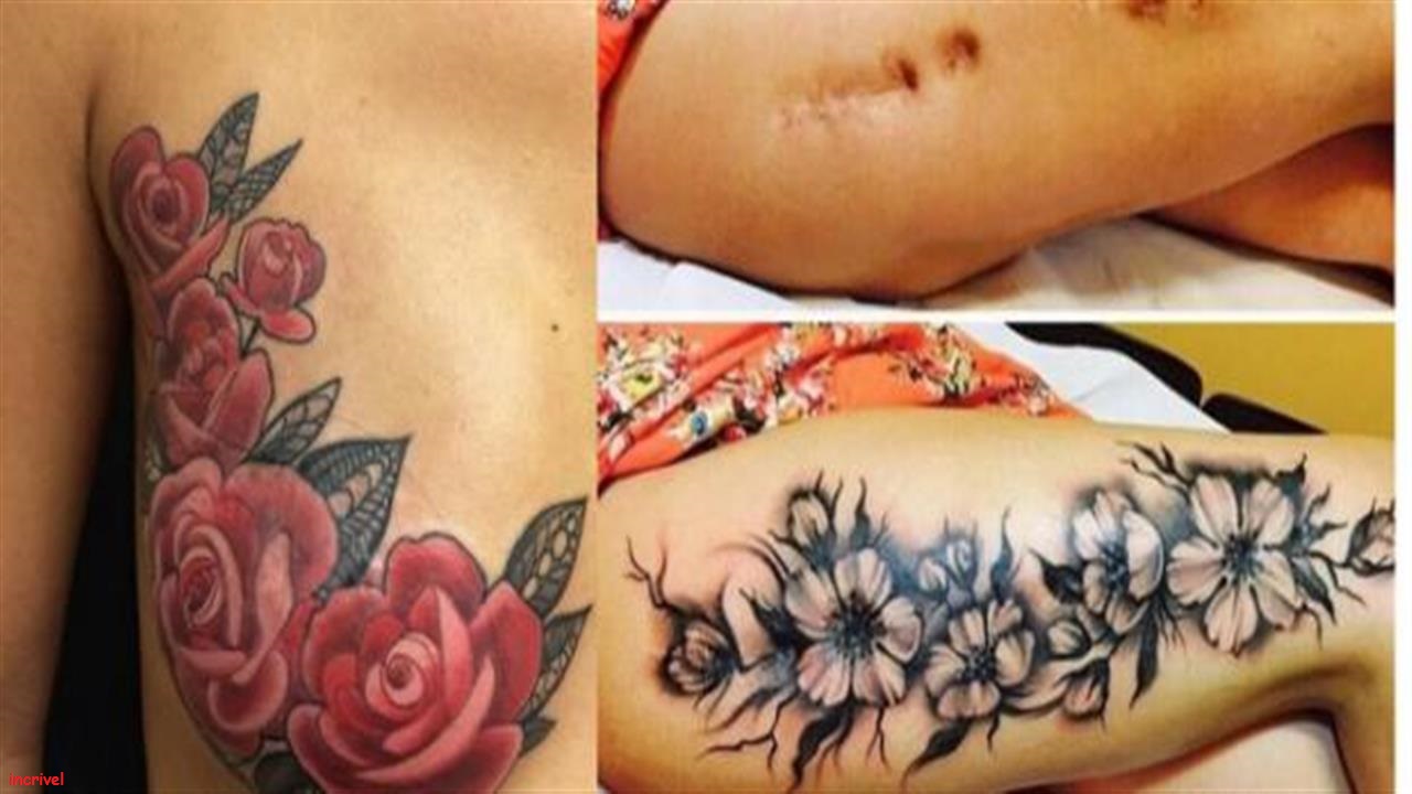 Cicatrizes que ganharam vida nova com tatuagem