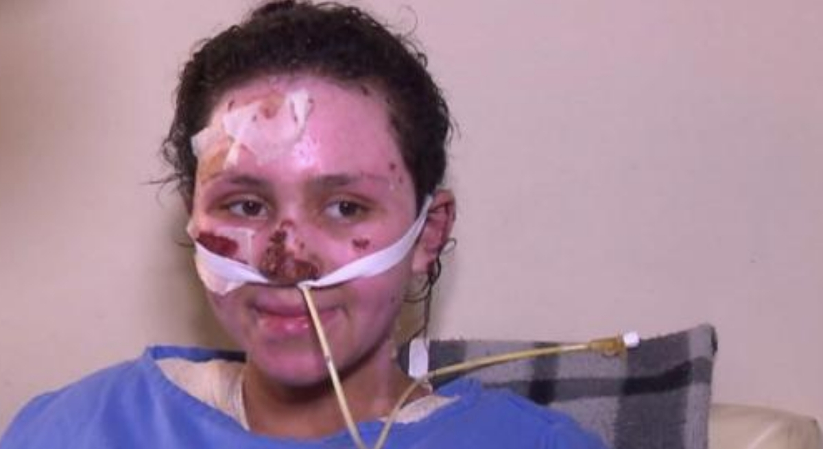 Adolescente que salvou irmão de 4 das chamas morre em Curitiba