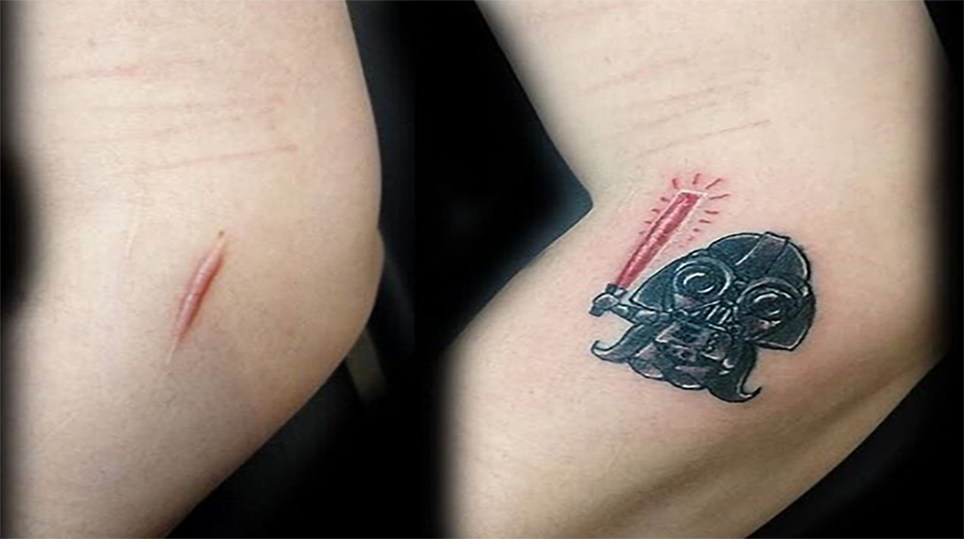 6 tattoos feitas para disfarçar cicatrizes ou manchas na pele