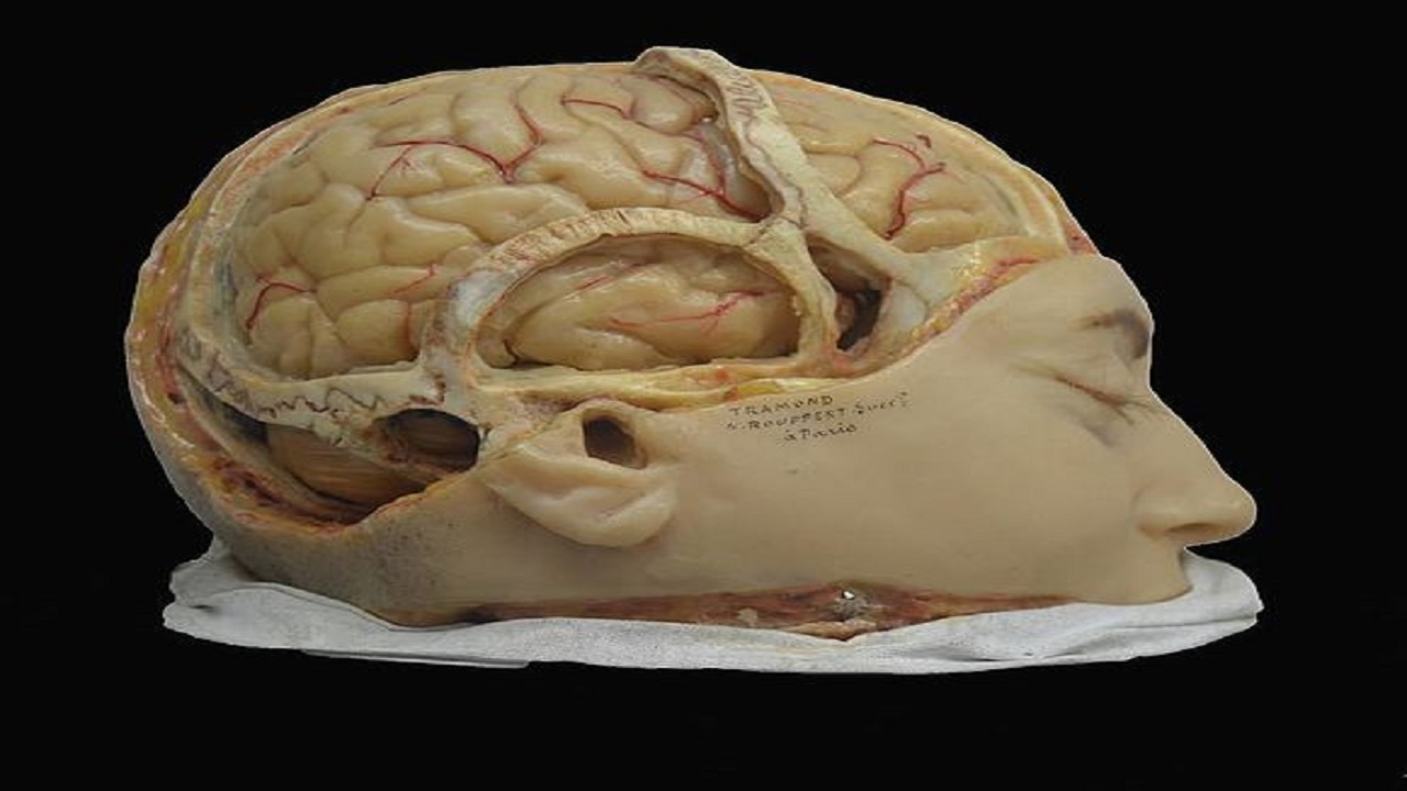 Una joven va al médico porque se sentía borracha y ven que se le salía el cerebro