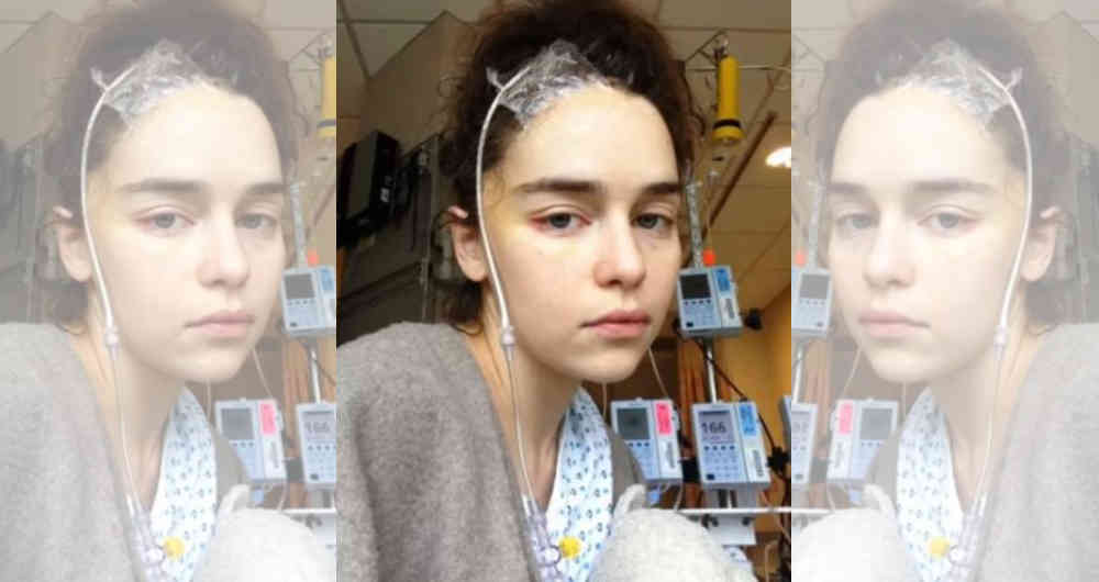 Emilia Clarke muestra fotos de su operación a causa de dos aneurismas