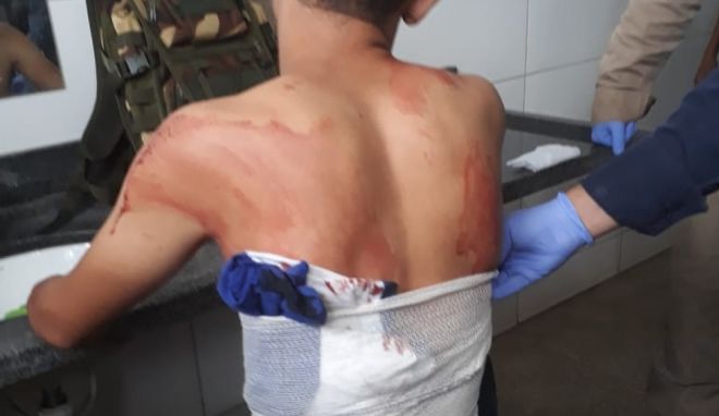 Médica é afastada após atender um paciente com o pulmão perfurado e liberá-lo