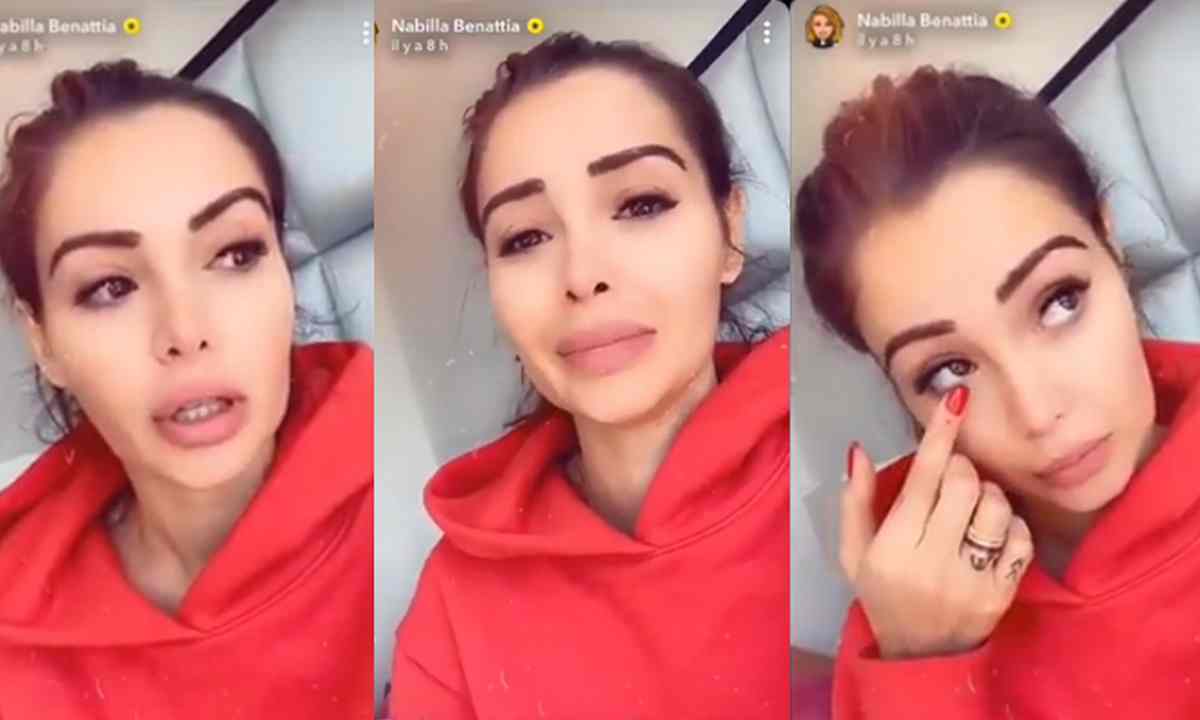 Nabilla Benattia enceinte : elle dévoile son visage couvert de boutons