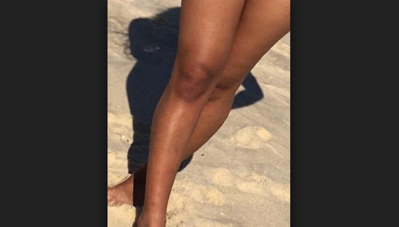 Bolsonaro aparece em joelho de banhista e foto viraliza na internet