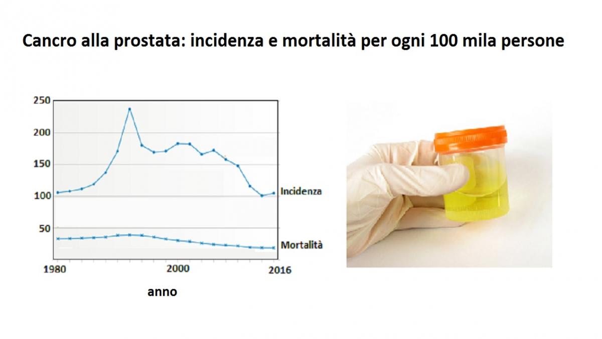 Braccialetti per il cancro alla prostata nel Regno Unito