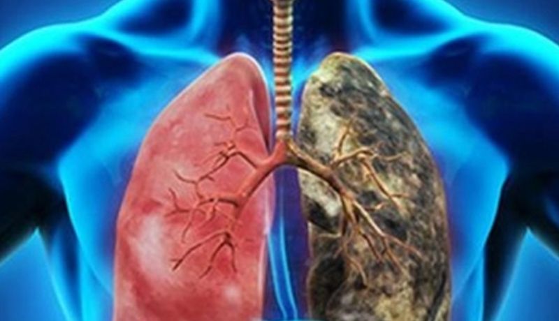 Según la OMS el consumo de tabaco mata a 8 millones de personas al año