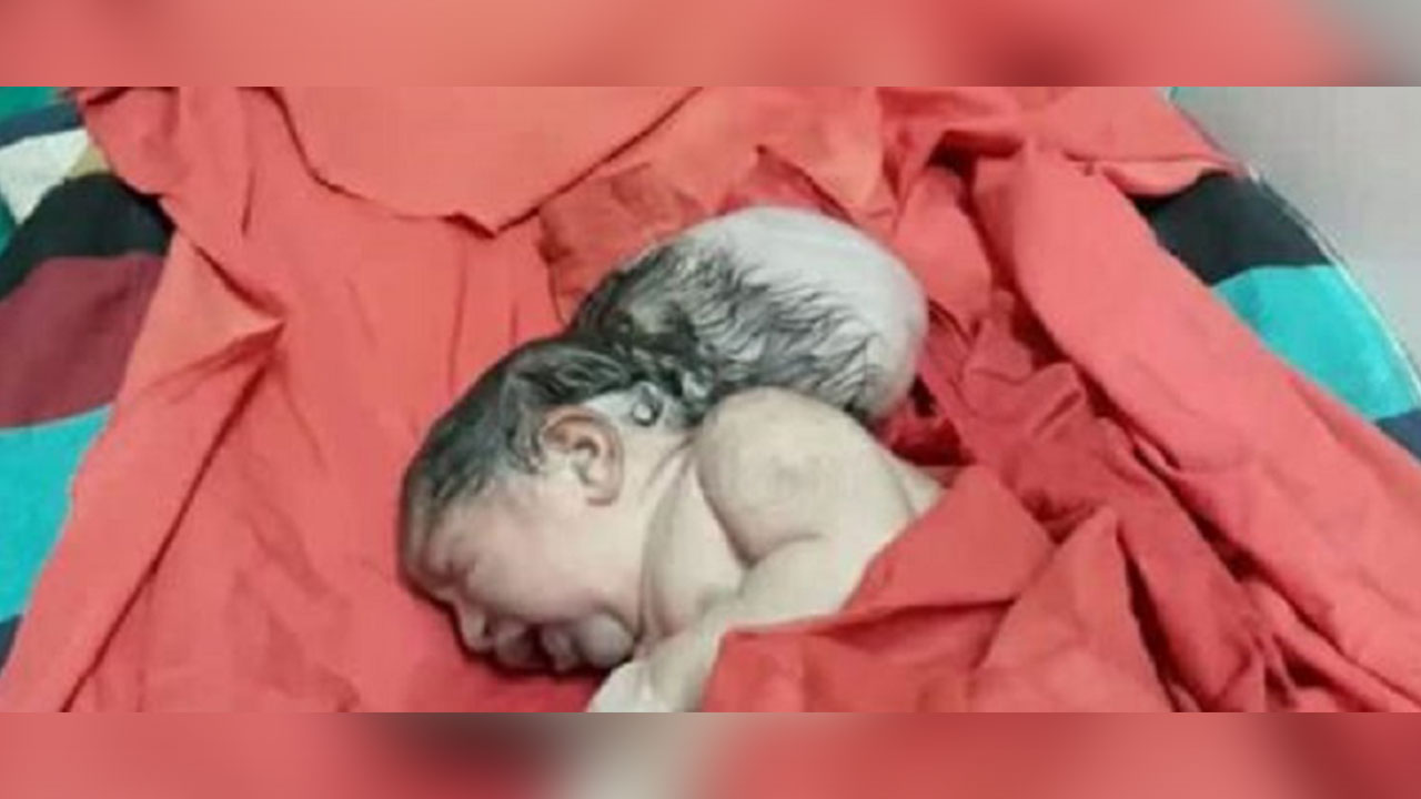 Ao saber que filho nasceu com três cabeças, pai tenta enterrar criança viva