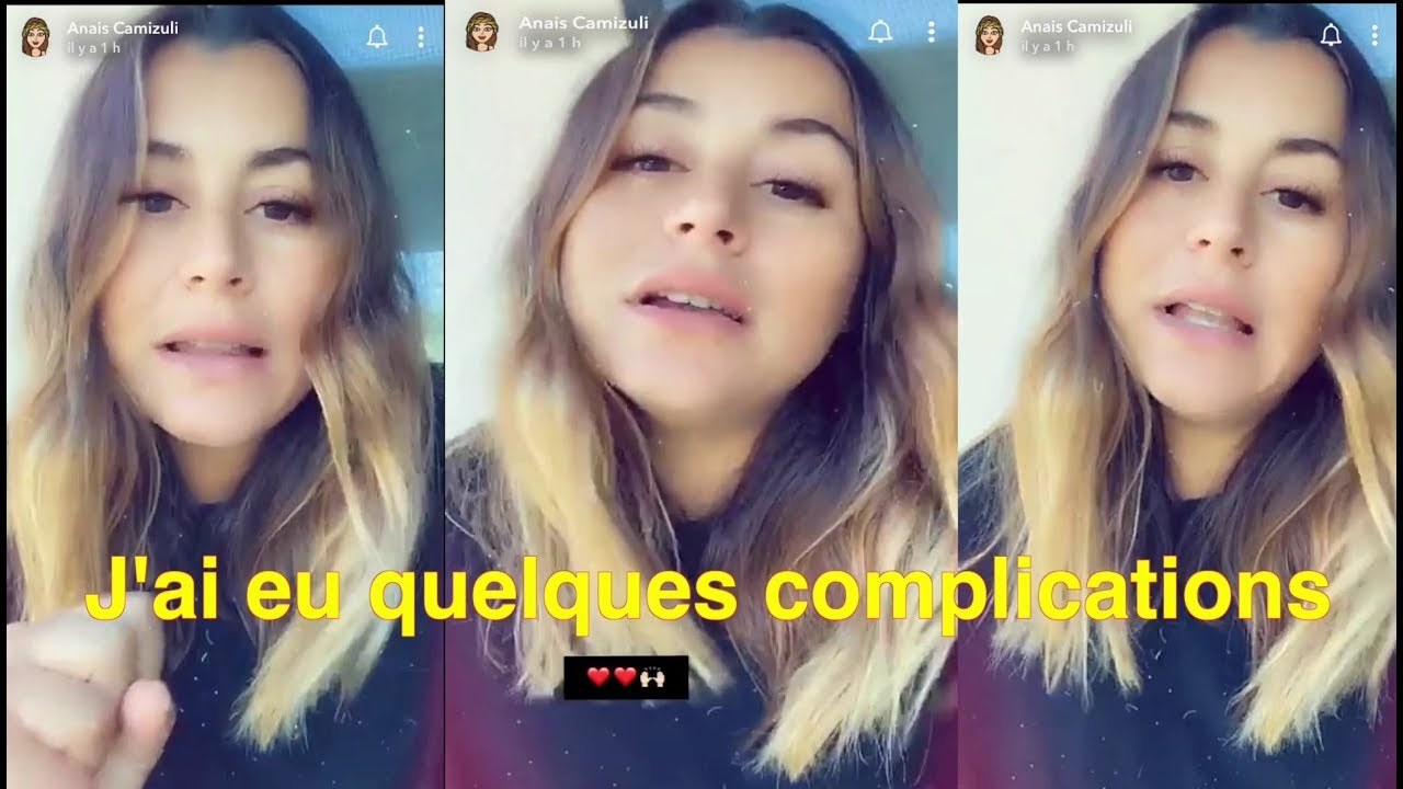 Anaïs Camizuli révèle les complications de son accouchement