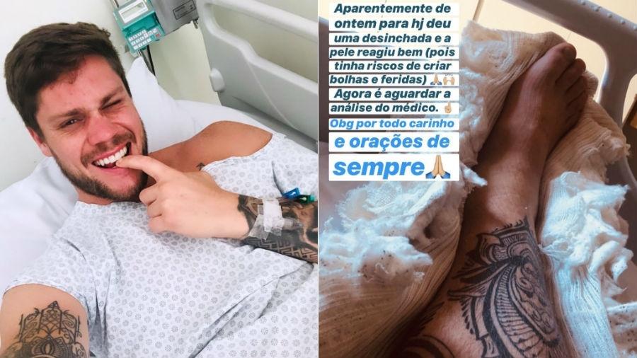 Ex-'BBB' Breno Simões passa por cirurgia após acidente em corrida