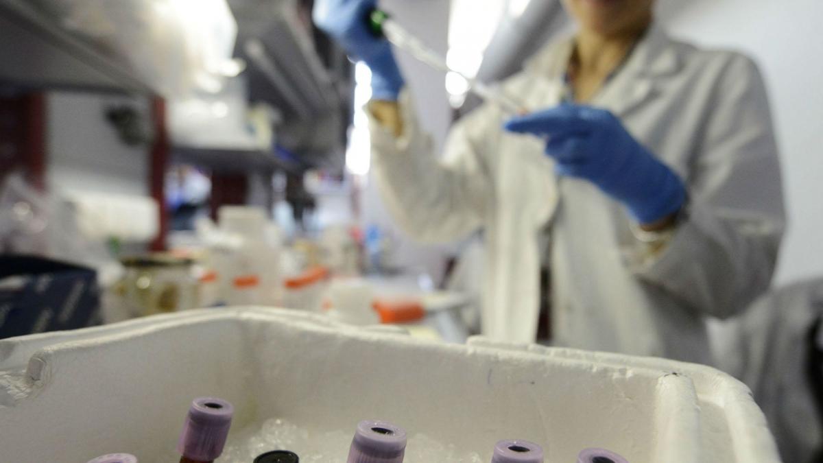 trattamento del cancro alla prostata allospedale universitario di Georgetown
