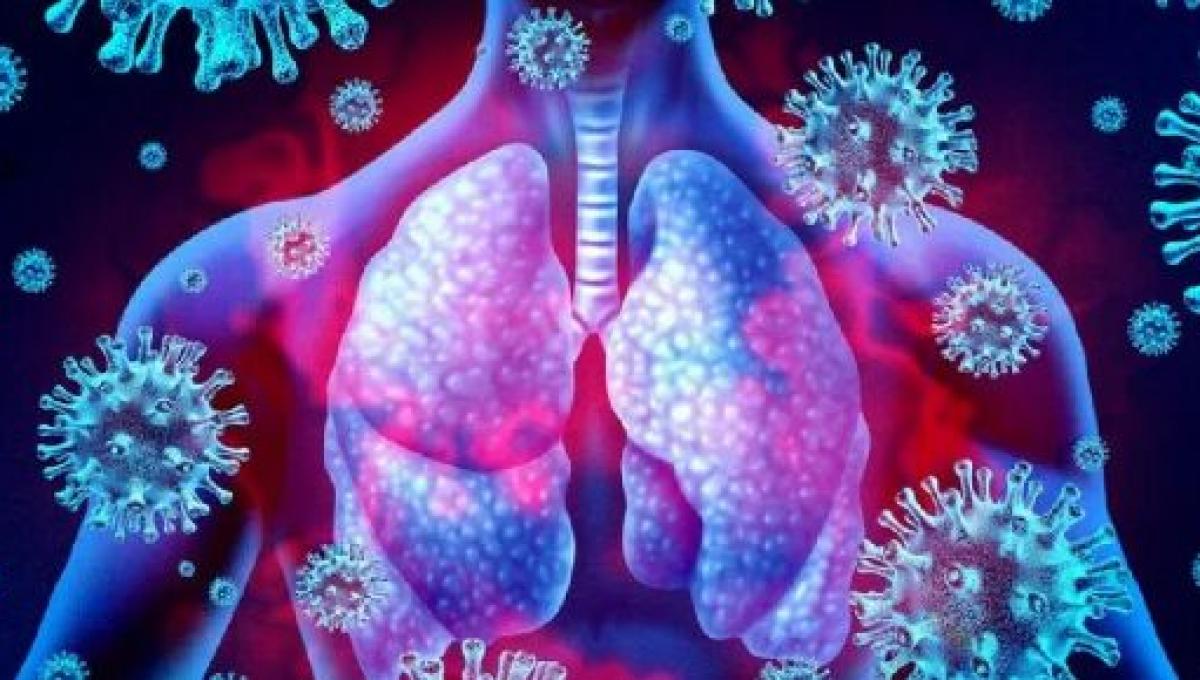 Covid19 causa infezioni polmonari 'con strascico' rischio cronicità